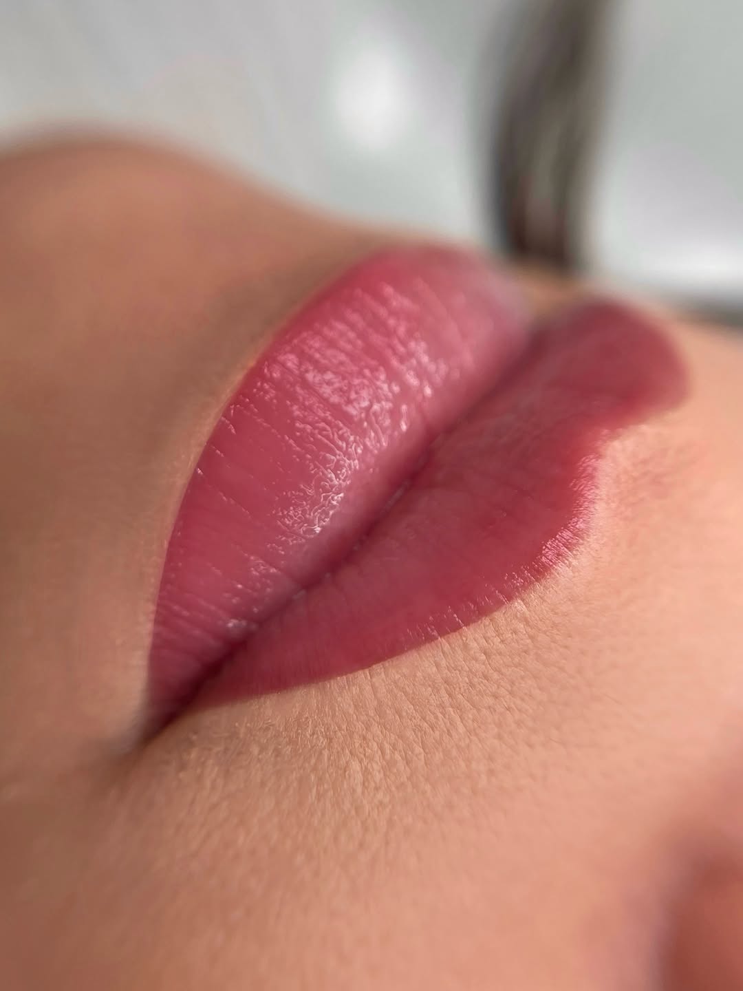 Dettaglio laterale di labbra dopo BOOP Lips
